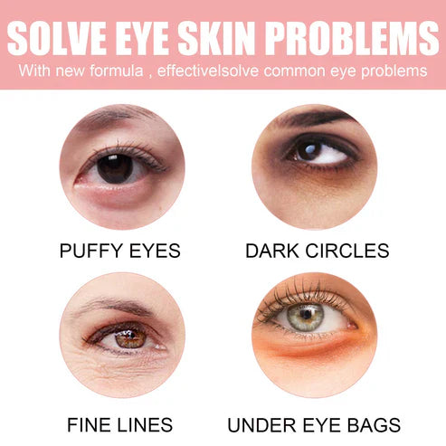 Fading Wrinkle Eye Bag Care